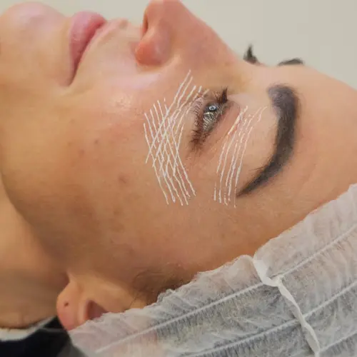 Lifting Facial - Kaesthetics