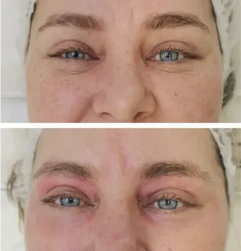 Olheira - Kaesthetics